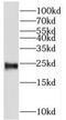 Pregnancy Specific Beta-1-Glycoprotein 11 antibody, FNab06856, FineTest, Western Blot image 