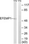 EGF Containing Fibulin Extracellular Matrix Protein 1 antibody, TA312976, Origene, Western Blot image 