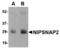 Nipsnap Homolog 2 antibody, A32476, Boster Biological Technology, Western Blot image 