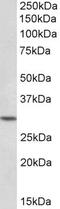 Homeobox protein Hox-C8 antibody, PA5-19379, Invitrogen Antibodies, Western Blot image 
