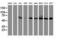 Cytochrome P450 Family 2 Subfamily B Member 6 antibody, LS-C337636, Lifespan Biosciences, Western Blot image 