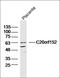 Zinc Finger MYM-Type Containing 2 antibody, orb158783, Biorbyt, Western Blot image 