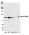 Rabenosyn, RAB Effector antibody, A304-948A, Bethyl Labs, Western Blot image 