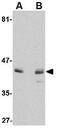 Activin A Receptor Type 1 antibody, GTX31779, GeneTex, Western Blot image 