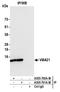Vacuolar ATPase Assembly Factor VMA21 antibody, A305-700A-M, Bethyl Labs, Immunoprecipitation image 