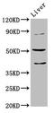 Cholinergic Receptor Nicotinic Beta 3 Subunit antibody, LS-C674998, Lifespan Biosciences, Western Blot image 