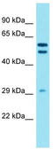 Dehydrogenase/Reductase 12 antibody, TA335464, Origene, Western Blot image 