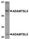 ADAMTS Like 5 antibody, orb75398, Biorbyt, Western Blot image 