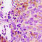 Protein Tyrosine Kinase 2 antibody, LS-C358276, Lifespan Biosciences, Immunohistochemistry frozen image 