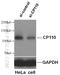 Centrosomal protein CP110 antibody, 12780-1-AP, Proteintech Group, Western Blot image 