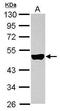 Keratin 33B antibody, GTX112454, GeneTex, Western Blot image 