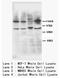 TNF Receptor Superfamily Member 1B antibody, AP23408PU-N, Origene, Western Blot image 
