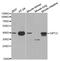 GIPC PDZ Domain Containing Family Member 2 antibody, LS-C331367, Lifespan Biosciences, Western Blot image 