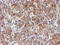 NADH:Ubiquinone Oxidoreductase Complex Assembly Factor 7 antibody, M12013-1, Boster Biological Technology, Immunohistochemistry paraffin image 