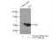 Glutaminase antibody, 19958-1-AP, Proteintech Group, Immunoprecipitation image 