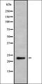 Matrilin 3 antibody, orb378170, Biorbyt, Western Blot image 