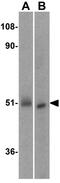 Interferon Regulatory Factor 3 antibody, GTX31695, GeneTex, Western Blot image 