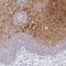 CDC42 Binding Protein Kinase Gamma antibody, HPA061836, Atlas Antibodies, Immunohistochemistry paraffin image 
