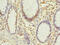 PHD Finger Protein 10 antibody, CSB-PA017898LA01HU, Cusabio, Immunohistochemistry paraffin image 
