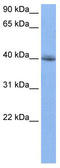 RNA Binding Fox-1 Homolog 2 antibody, TA345759, Origene, Western Blot image 