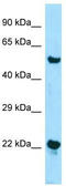 Zinc Finger DHHC-Type Containing 12 antibody, TA343019, Origene, Western Blot image 