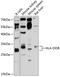 Major Histocompatibility Complex, Class II, DO Beta antibody, 14-282, ProSci, Western Blot image 