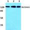 Solute Carrier Family 24 Member 1 antibody, A10359, Boster Biological Technology, Western Blot image 