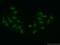 Probable ATP-dependent RNA helicase DDX52 antibody, 16660-1-AP, Proteintech Group, Immunofluorescence image 
