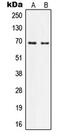 IQ Motif Containing B1 antibody, MBS821227, MyBioSource, Western Blot image 