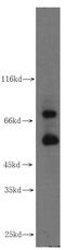 Matrix Metallopeptidase 2 antibody, FNab05238, FineTest, Western Blot image 