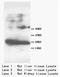 Fatty Acid Binding Protein 1 antibody, AP23314PU-N, Origene, Western Blot image 