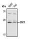 Peptidyl-TRNA Hydrolase 2 antibody, PA5-17327, Invitrogen Antibodies, Western Blot image 