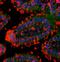 Colony Stimulating Factor 2 Receptor Alpha Subunit antibody, orb10732, Biorbyt, Immunohistochemistry paraffin image 