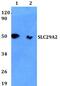 Solute Carrier Family 29 Member 2 antibody, PA5-75769, Invitrogen Antibodies, Western Blot image 