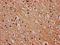 Saitohin antibody, LS-C681479, Lifespan Biosciences, Immunohistochemistry paraffin image 