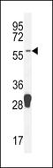 Molybdenum Cofactor Synthesis 1 antibody, 55-108, ProSci, Western Blot image 
