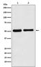Fascin Actin-Bundling Protein 1 antibody, M02147-1, Boster Biological Technology, Western Blot image 