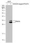 Platelet Derived Growth Factor Subunit A antibody, GTX110647, GeneTex, Western Blot image 