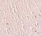 Leucine-rich repeat transmembrane neuronal protein 3 antibody, PA5-21098, Invitrogen Antibodies, Immunohistochemistry frozen image 