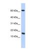 Chromosome 4 Open Reading Frame 46 antibody, NBP1-56427, Novus Biologicals, Western Blot image 