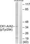 Casein Kinase 1 Alpha 1 antibody, TA313699, Origene, Western Blot image 