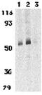 C-C Motif Chemokine Receptor 3 antibody, GTX31254, GeneTex, Western Blot image 