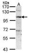 Amine Oxidase Copper Containing 3 antibody, GTX101400, GeneTex, Western Blot image 