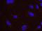 SMG1 antibody, NB100-77278, Novus Biologicals, Proximity Ligation Assay image 