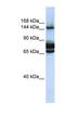 Family With Sequence Similarity 83 Member B antibody, NBP1-79546, Novus Biologicals, Western Blot image 