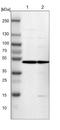 Zinc Finger Protein 341 antibody, NBP1-84218, Novus Biologicals, Western Blot image 