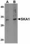 Spindle And Kinetochore Associated Complex Subunit 1 antibody, orb94326, Biorbyt, Western Blot image 