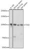 Toll Like Receptor 2 antibody, GTX33547, GeneTex, Western Blot image 