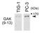Cyclin G Associated Kinase antibody, GTX00873, GeneTex, Western Blot image 