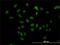 Transducin Beta Like 1 X-Linked Receptor 1 antibody, H00079718-M01, Novus Biologicals, Immunocytochemistry image 